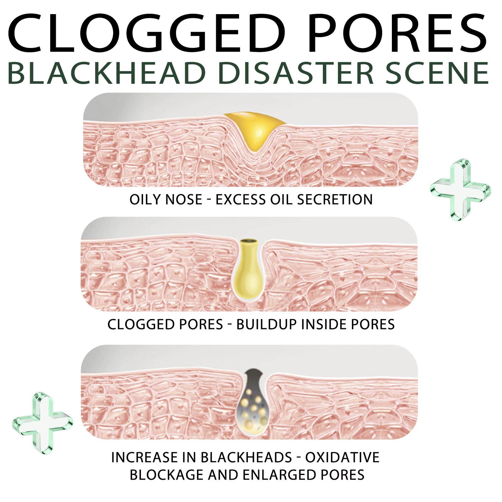 Blackhead Remover Tools -15g Blackhead Creamwith 40Pcs Blackhead Pore Strips - Image 8